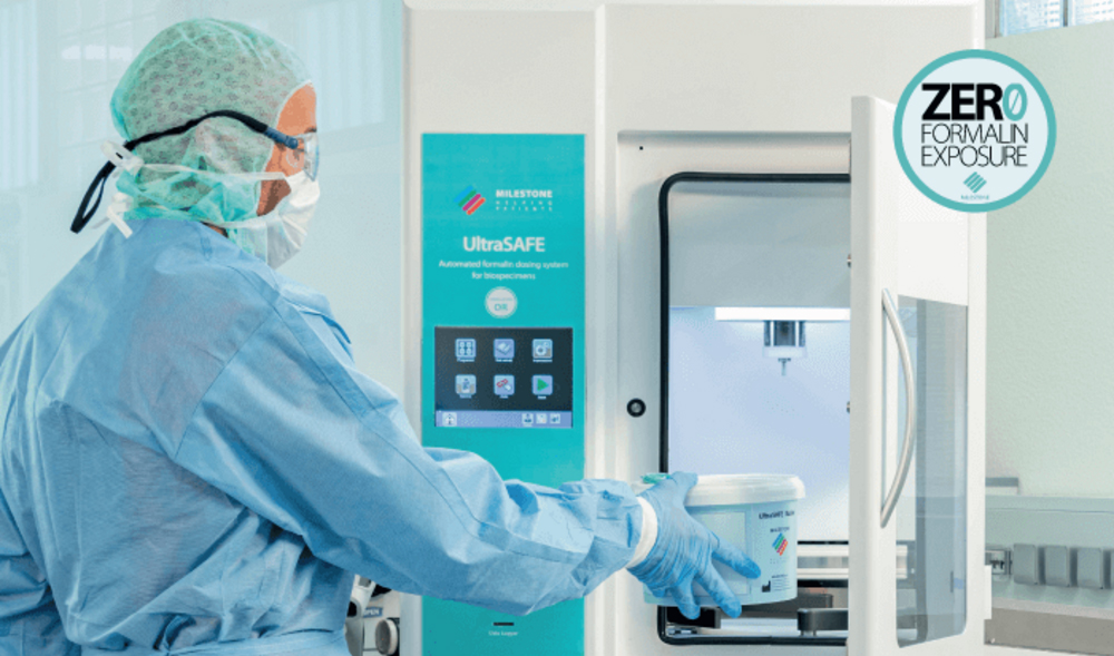 UltraSafe – Exposição zero de formol no manuseio de peças cirúrgicas