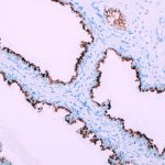 Novembro Azul – Conheça nossos destaques em imunohistoquímica para o painel de próstata!